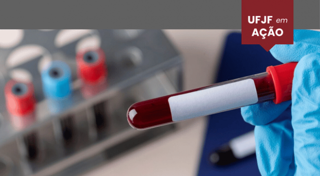 Faculdade de Farmácia se prepara para realizar exames de hepatite A no município