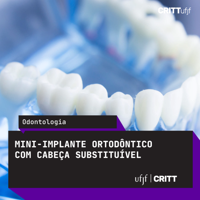 Mini Implante Ortodôntico com Cabeça Substituível - BR 20 2016 014 962 8